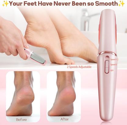 PediShine™ - Pedicure Electric Foot Callus Remover